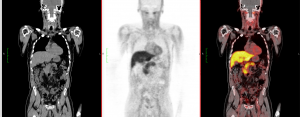 Three different imaging scans