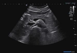 An ultrasound of the abdominal area.