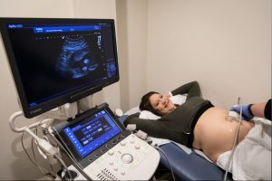 A woman having an ultrasound perfomred
